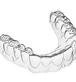 Răng khểnh có nên niềng răng bằng khay trong suốt ADClearAligner không?